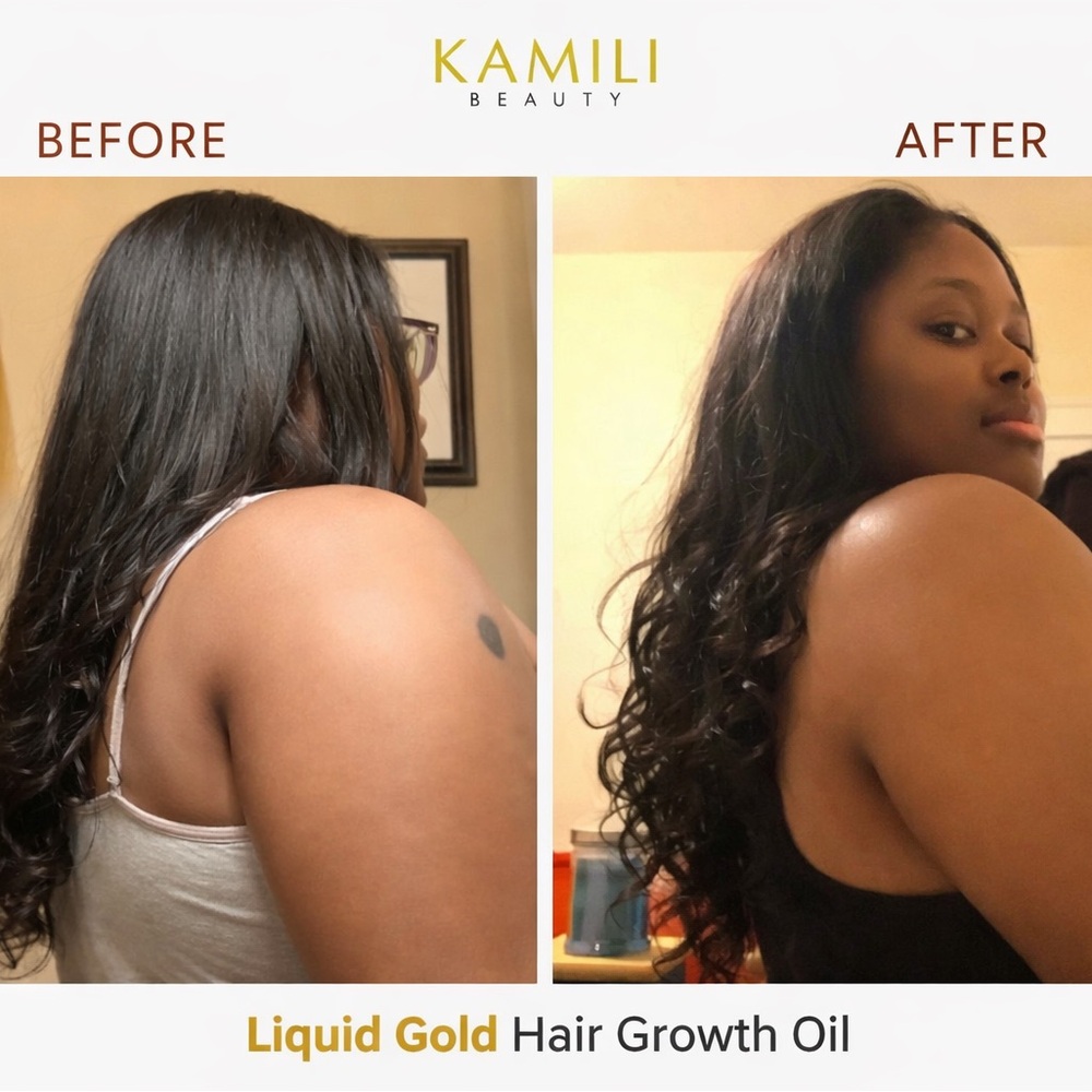 “Liquid Gold” Hair Growth Oil x KAMILI